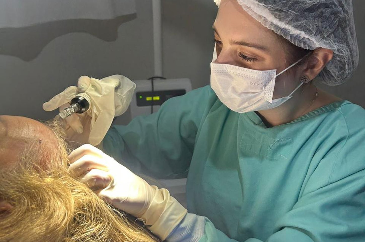 Alopecia: muito mais do que uma simples queda de cabelos