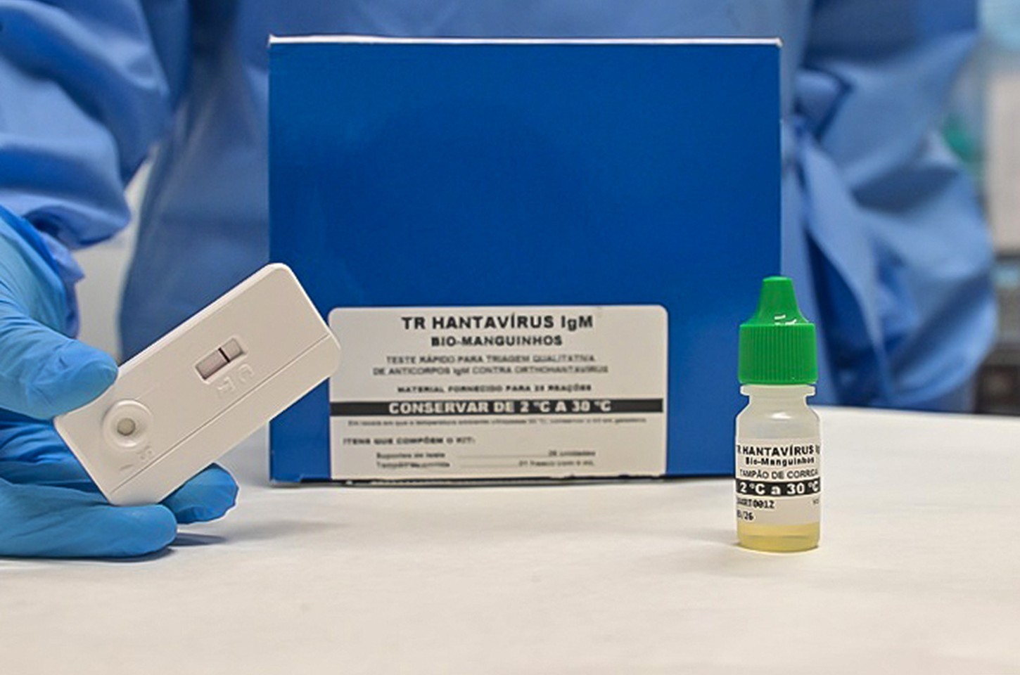 Anvisa aprova teste rápido para hantavirose que dá resultado em 20 minutos