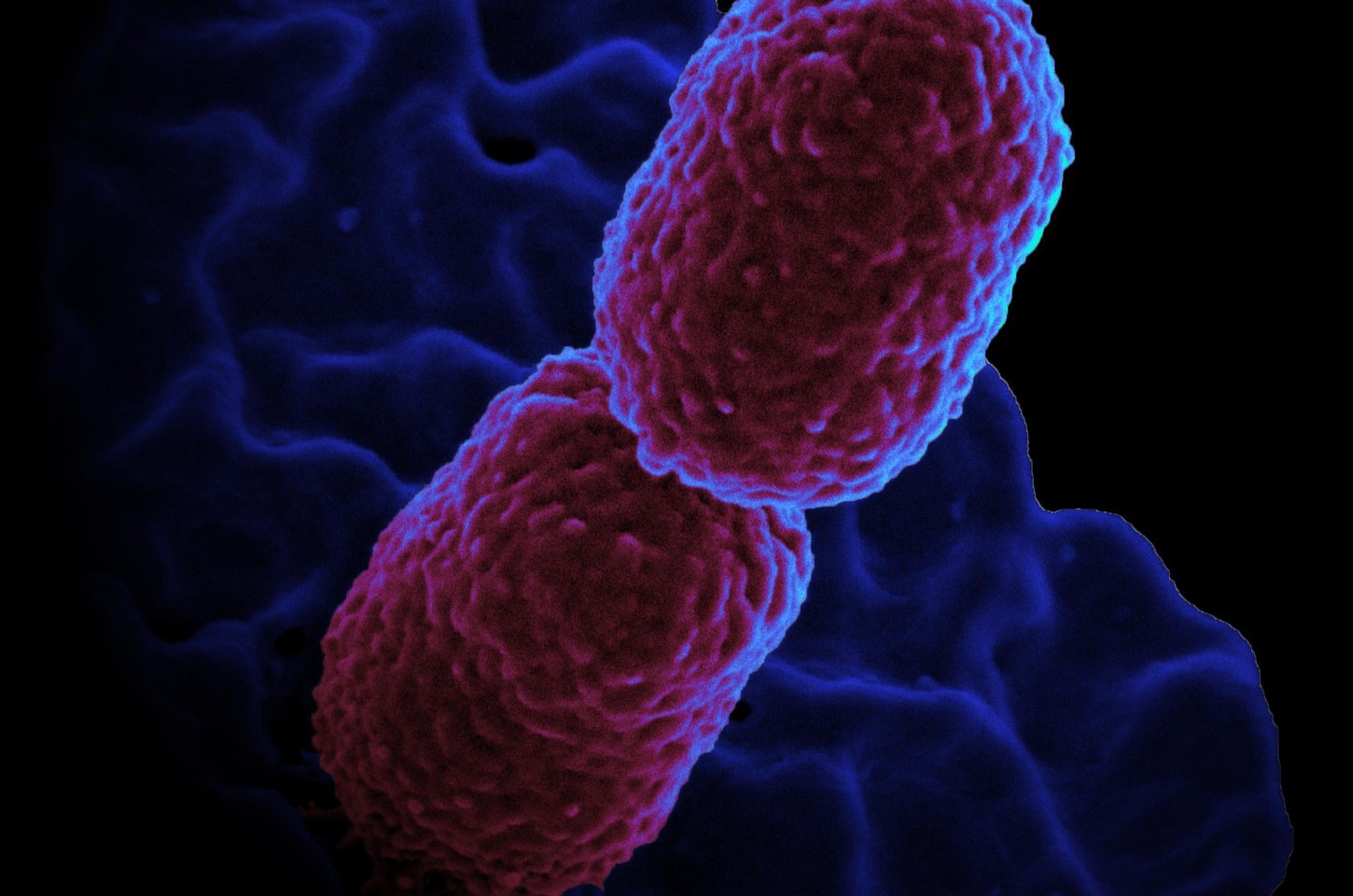 Bactéria multirresistente leva à restrição de UTI em hospital de Campinas