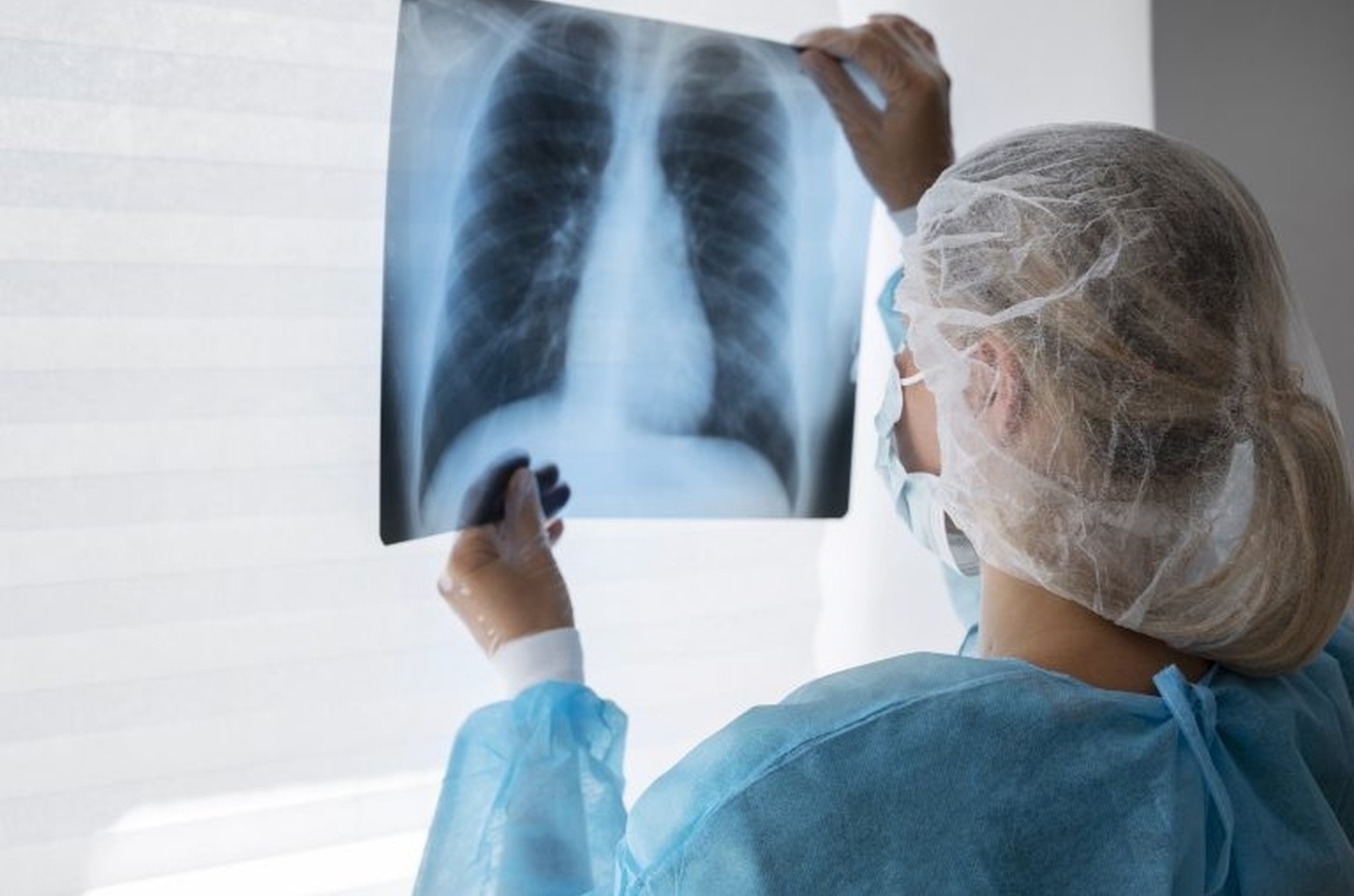 Biopsia líquida acelera diagnóstico de câncer de pulmão no Brasil