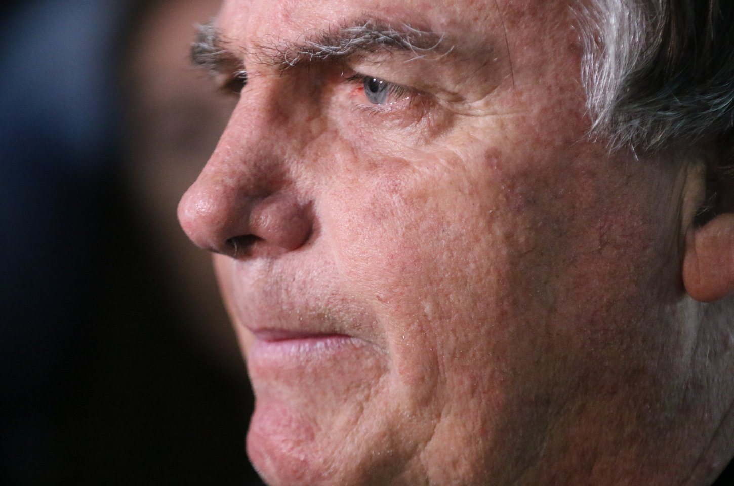 Bolsonaro volta à cirurgia após nova crise de soluços