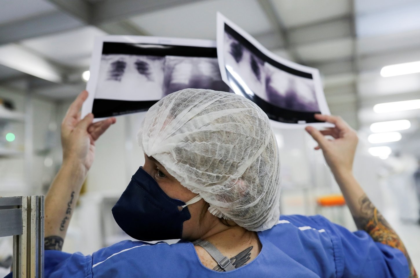 Brasil deve registrar 781 mil novos casos de câncer por ano até 2028