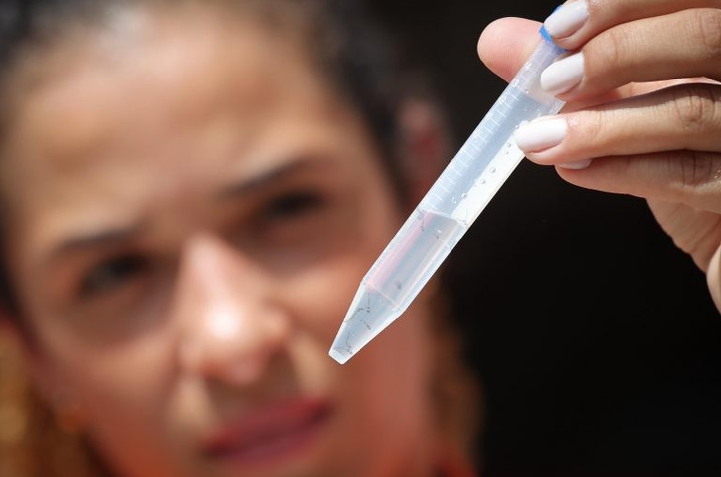 Calor intenso em SP aumenta risco de dengue; saiba como se proteger