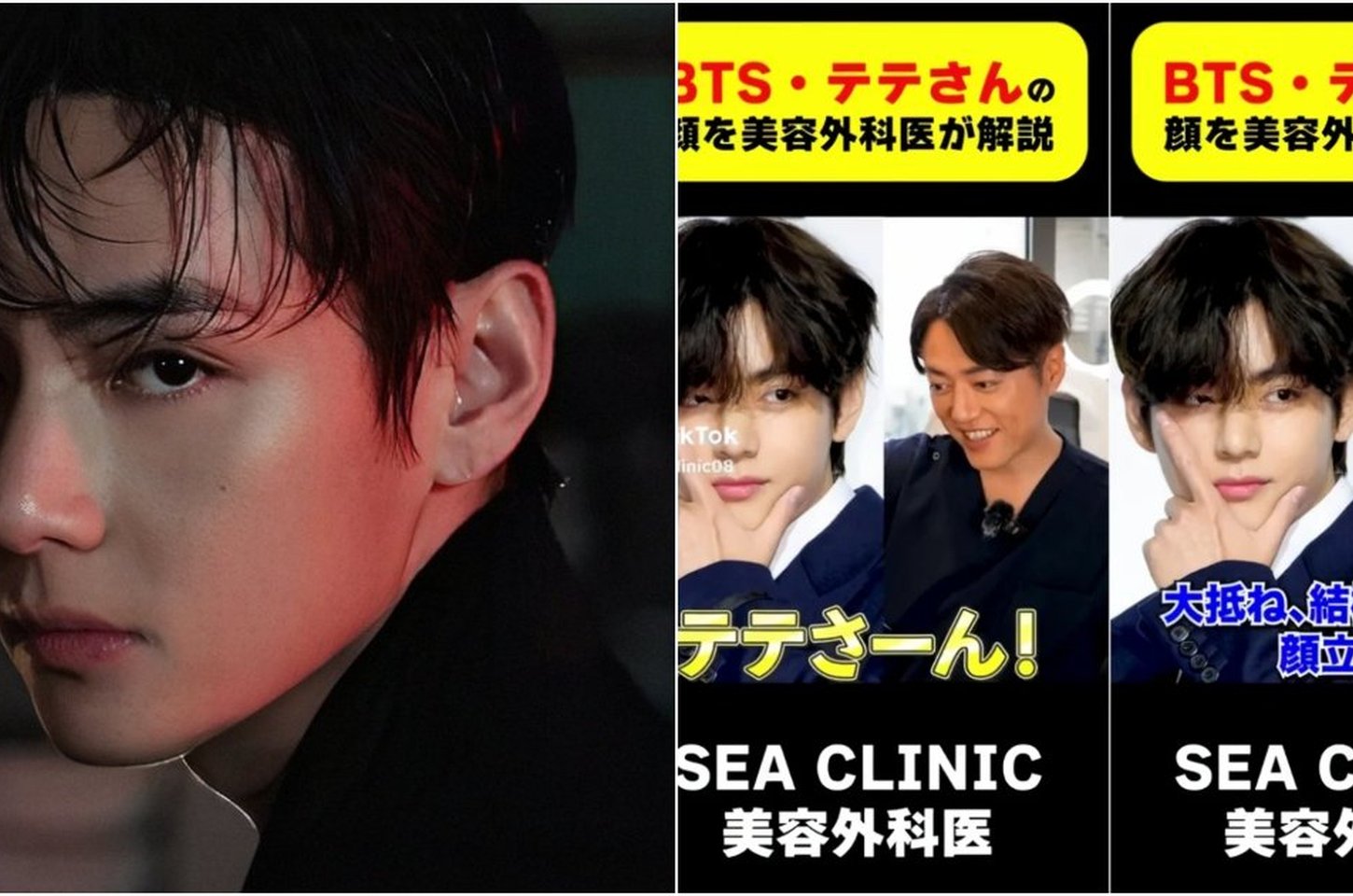 Cirurgião plástico japonês analisa rosto de V do BTS e o chama de "tesouro nacional"