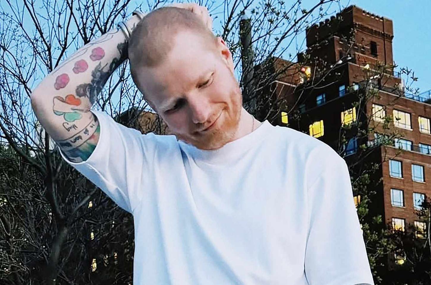 Ed Sheeran raspa a cabeça e revela batalha contra herpes-zóster