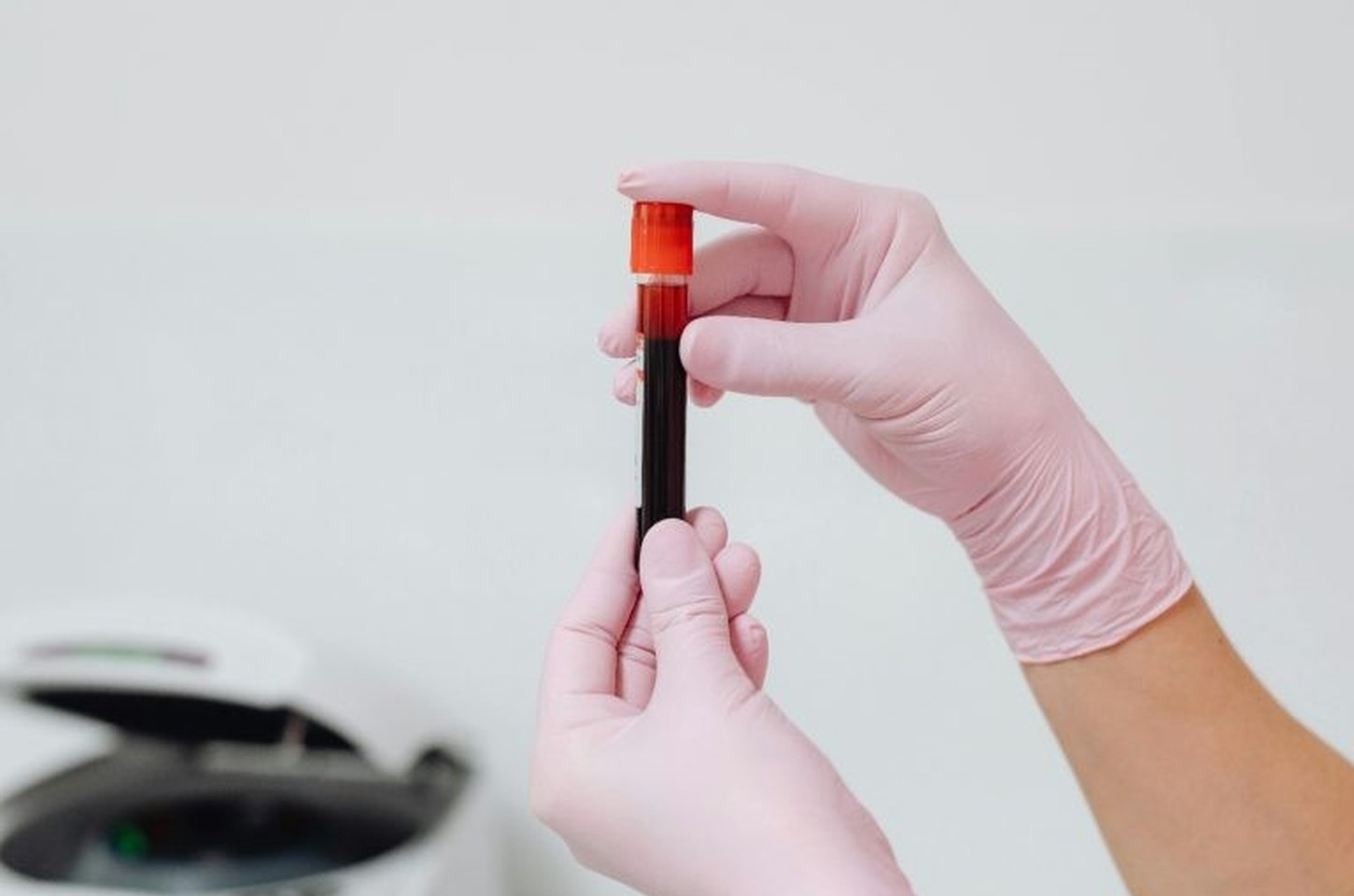 Estoque de sangue O- está crítico no HSPE; hospital pede doações urgentes