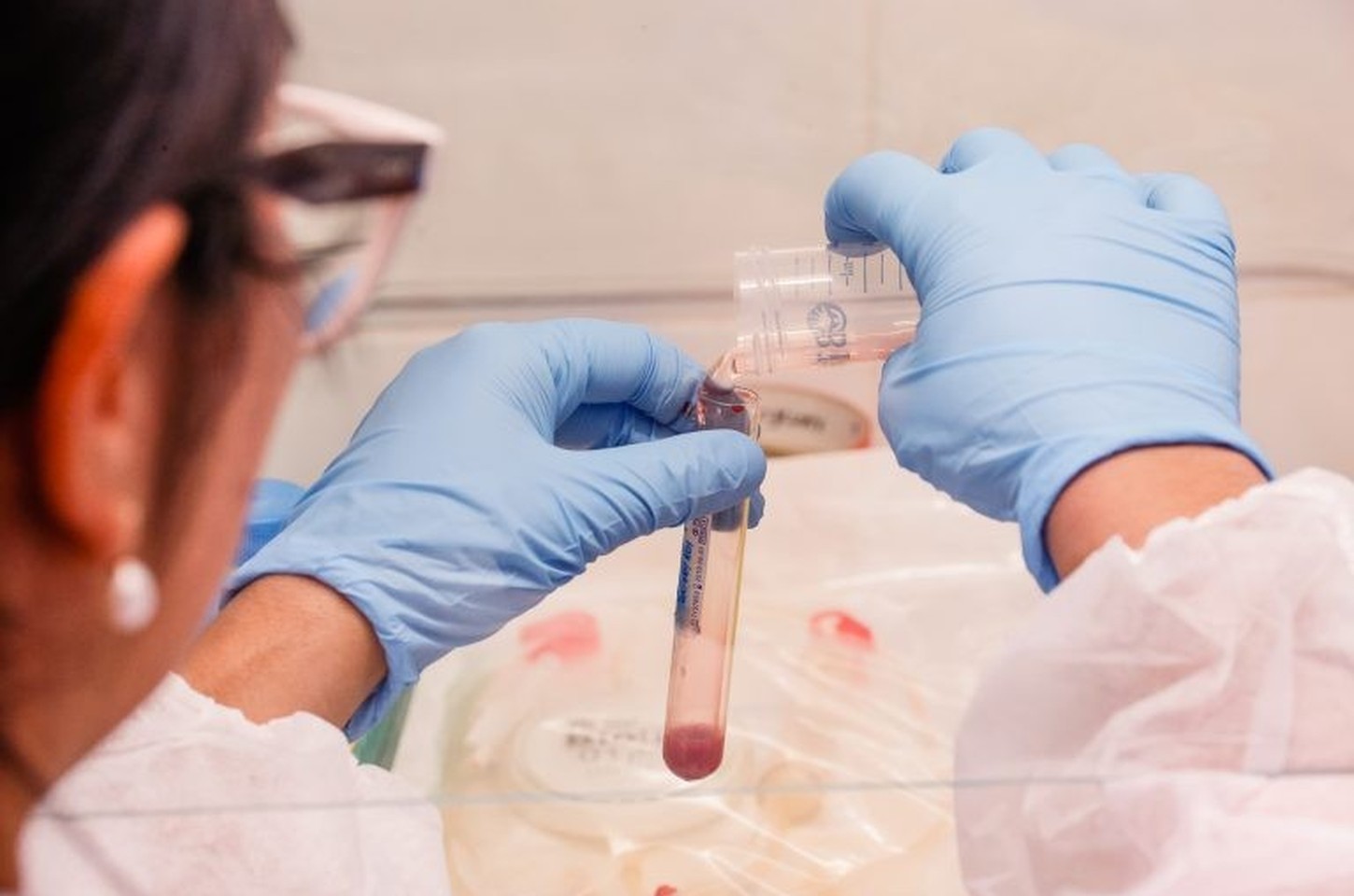 Exame de sangue com IA pode revolucionar diagnóstico precoce da hanseníase