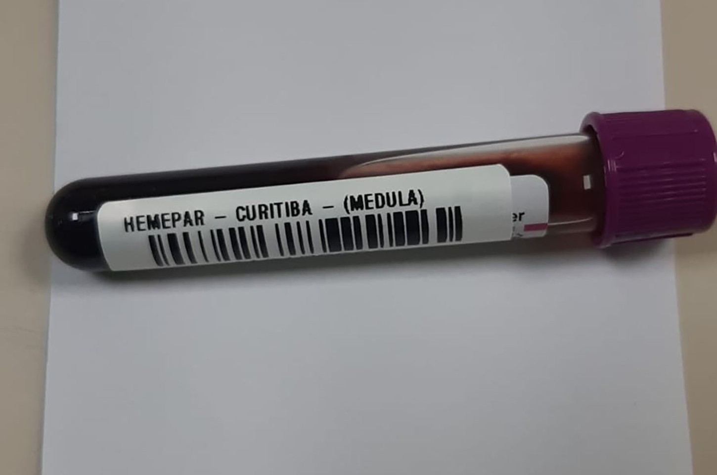 Fevereiro laranja alerta para a leucemia e a importância do diagnóstico precoce