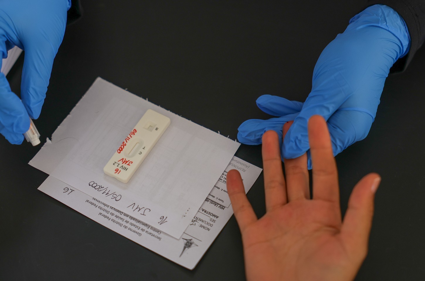 Governo prioriza medicamento de longa duração contra HIV, mas preço é obstáculo