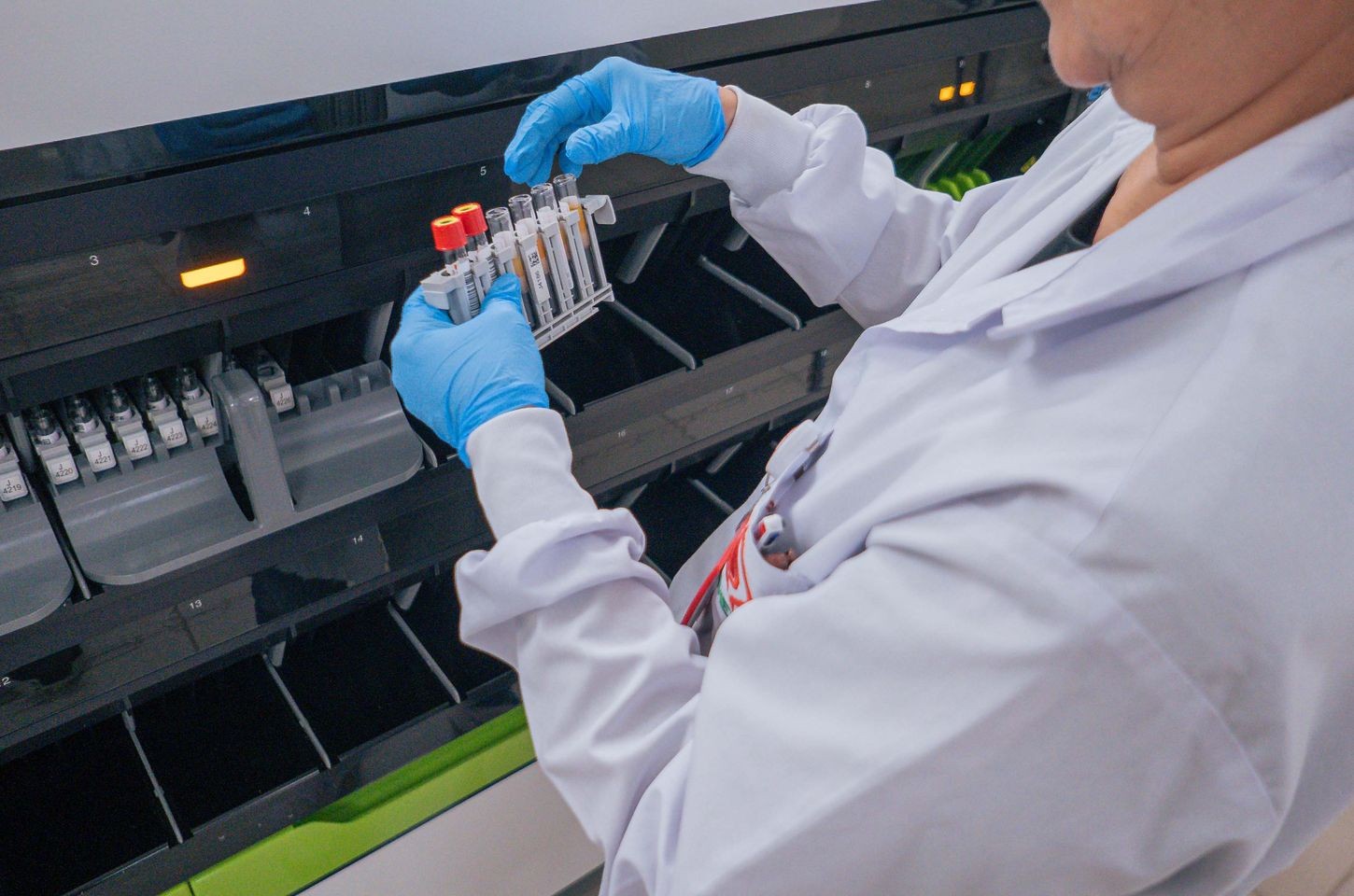 Paraná inova com parceria inédita para aumentar segurança em transplantes