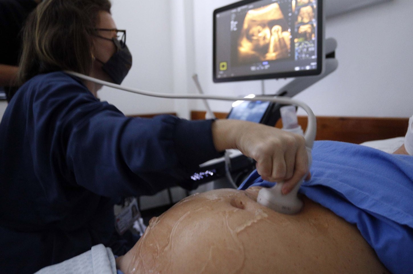 Paraná lidera redução da gravidez na adolescência no Brasil