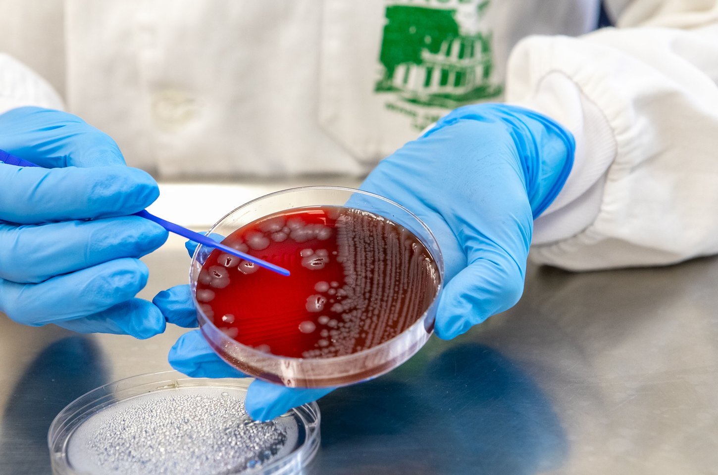 Sesa alerta para aumento de viroses no Paraná com a chegada do verão