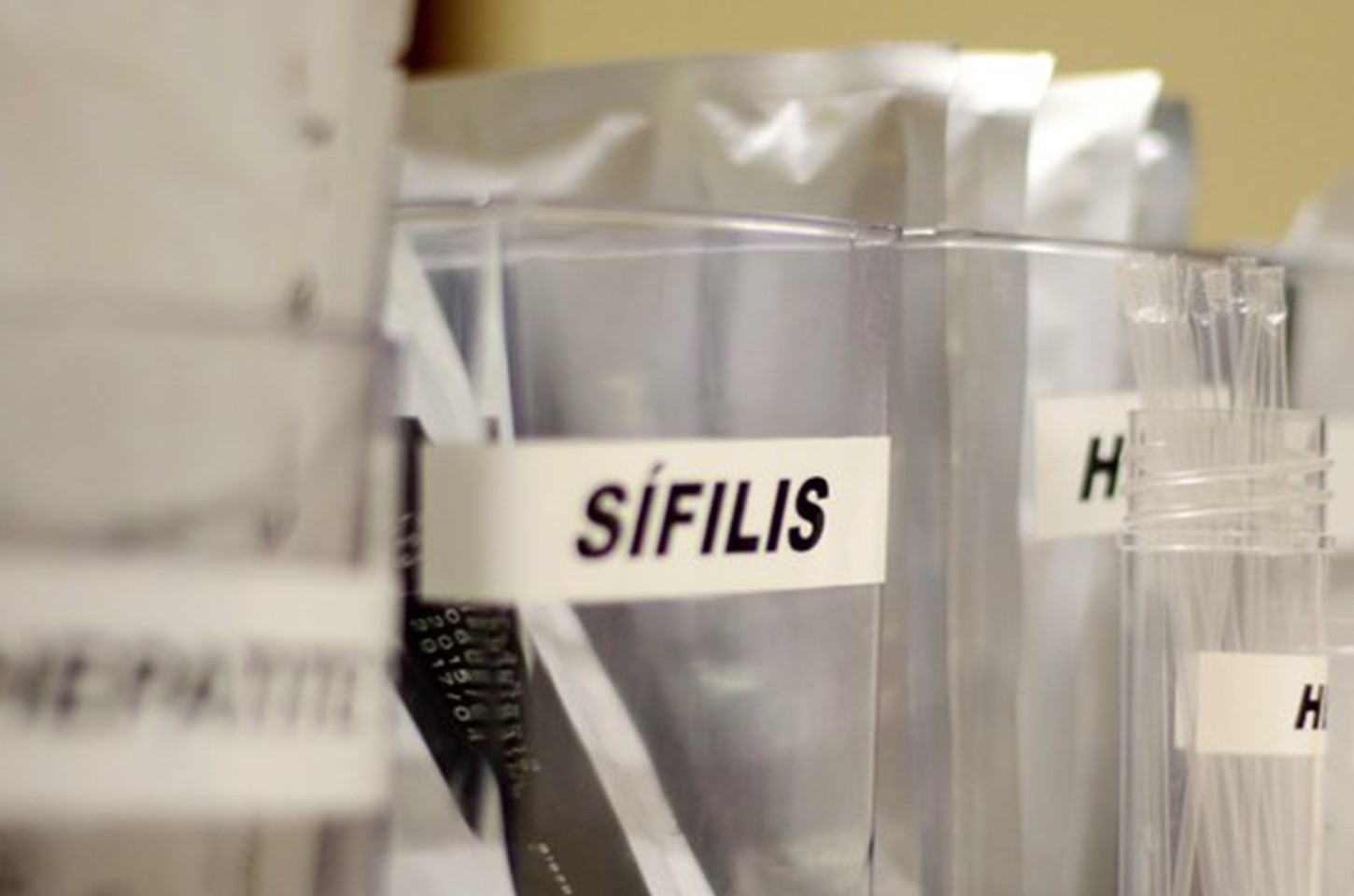 SUS amplia uso de antibiótico para prevenir sífilis e clamídia