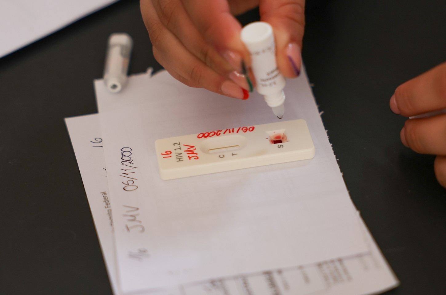 Testagem gratuita de HIV marca Dezembro Vermelho em Brasília